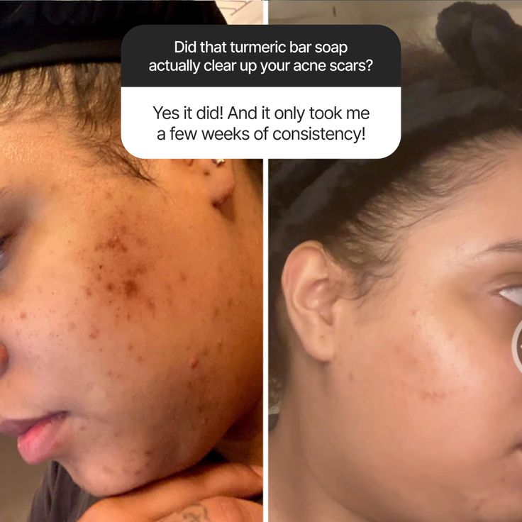 Daily Care Essentials: Cleanser, Toner, Moisturizer & Serum