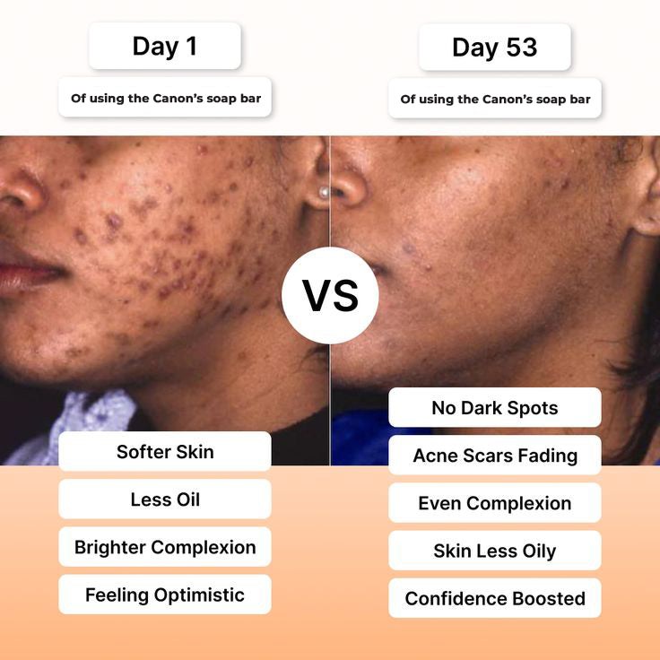 Daily Care Essentials: Cleanser, Toner, Moisturizer & Serum